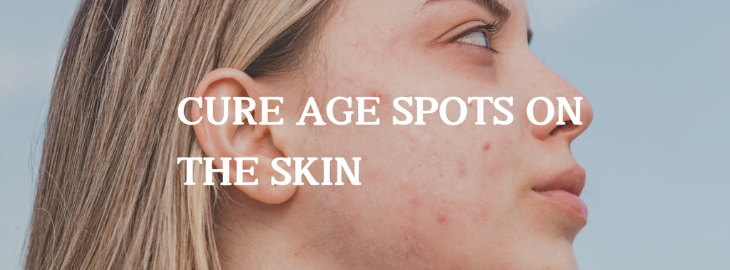 Age Spots on Face: Causes, Treatments, and Prevention for Clearer Skin